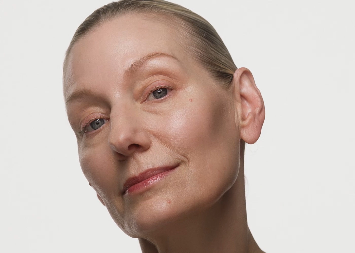How to Combat Dark Circles